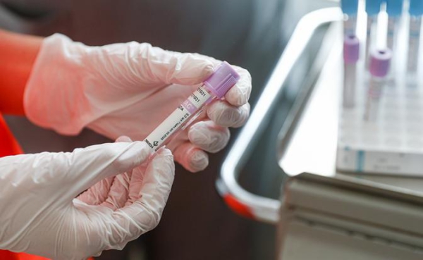 Онколог рассказала, какие анализы могут помочь обнаружить рак