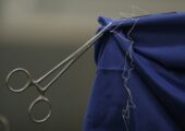 Темно-синий кровоток: российские нейрохирурги по-новому взглянули на кровоснабжение мозга