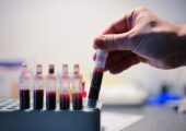 Ученые нашли способ выявлять болезнь Альцгеймера за десятилетия до симптомов