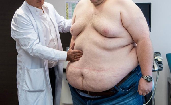 Слишком жирно — терять триллионы рублей из-за не в меру упитанных сограждан Слишком жирно — терять триллионы рублей из-за не в меру упитанных сограждан